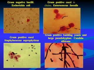 Gram negative bacilli. Escherichia coli Gram positive cocci  in chains.  Enterococcus faecalis Gram positive cocci   Staphylococcus saprophyticus Gram positive budding yeasts and large pseudohyphae. Candida albicans 