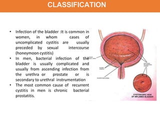 CLASSIFICATION
• Infection of the bladder :It is common in
women, in whom cases of
uncomplicated cystitis are usually
preceded by sexual intercourse
(honeymoon cystitis)
• In men, bacterial infection of the
bladder is usually complicated and
usually from ascending infection from
the urethra or prostate or is
secondary to urethral instrumentation
• The most common cause of recurrent
cystitis in men is chronic bacterial
prostatitis.
 