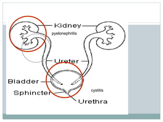 pyelonephritis
cystitis
 