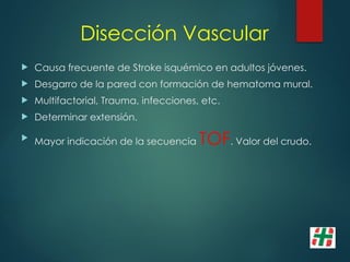 Disección Vascular
 Causa frecuente de Stroke isquémico en adultos jóvenes.
 Desgarro de la pared con formación de hematoma mural.
 Multifactorial, Trauma, infecciones, etc.
 Determinar extensión.

Mayor indicación de la secuencia TOF. Valor del crudo.
 