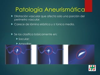 Patología Aneurismática
 Dilatación vascular que afecta solo una porción del
perímetro vascular.
 Carece de lámina elástica y ± túnica media.
 Se los clasifica básicamente en:
 Sacular;
 Ampollar;
 Fusiforme.
 