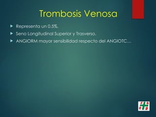 Trombosis Venosa
 Representa un 0.5%.
 Seno Longitudinal Superior y Trasverso.
 ANGIORM mayor sensibilidad respecto del ANGIOTC…
 