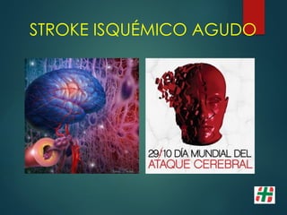 STROKE ISQUÉMICO AGUDO
 