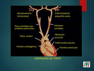 Estenosis
carotidea
Enfermedad de
pequeños vasos
Fibrilación
auricular
Enfermedad valvular
Trombo ventricular
Embolo cardiogénico
Placa aortica
Placa carotidea con
embolos potenciales
Ateroesclerosis
intracraneal
Clasificación de TOAST
 