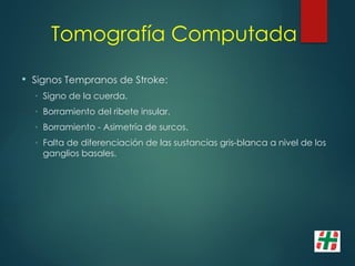 Tomografía Computada
 Signos Tempranos de Stroke:
◦ Signo de la cuerda.
◦ Borramiento del ribete insular.
◦ Borramiento - Asimetría de surcos.
◦ Falta de diferenciación de las sustancias gris-blanca a nivel de los
ganglios basales.
 