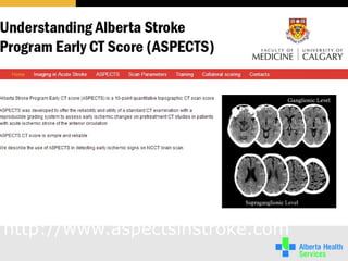 http://www.aspectsinstroke.com
 