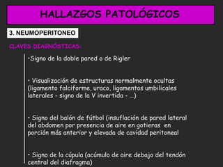 Utilidad de la_radiografia_de_abdomen_en_la_urgencia | PDF