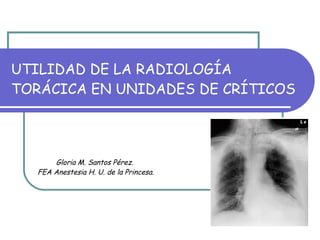 UTILIDAD DE LA RADIOLOGÍA TORÁCICA EN UNIDADES DE CRÍTICOS Gloria M. Santos Pérez.  FEA Anestesia H. U. de la Princesa. 