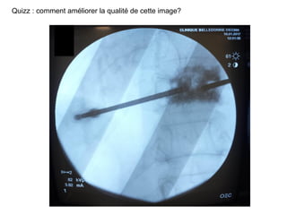 Quizz : comment améliorer la qualité de cette image?
 