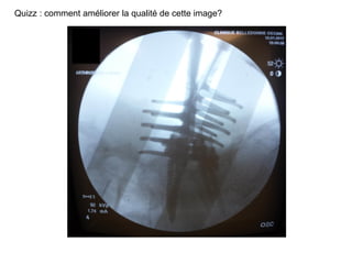Quizz : comment améliorer la qualité de cette image?
 