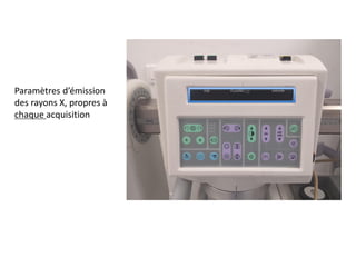 Paramètres d’émission
des rayons X, propres à
chaque acquisition
 