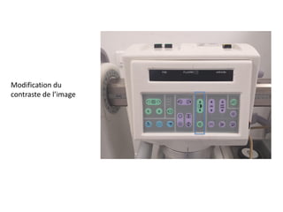 Modification du
contraste de l’image
 
