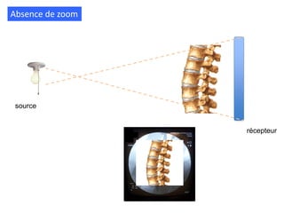 Absence de zoom
source
récepteur
 