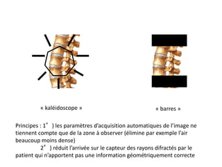 « kaléidoscope » « barres »
Principes : 1°) les paramètres d’acquisition automatiques de l’image ne
tiennent compte que de la zone à observer (élimine par exemple l’air
beaucoup moins dense)
2°) réduit l’arrivée sur le capteur des rayons difractés par le
patient qui n’apportent pas une information géométriquement correcte
 