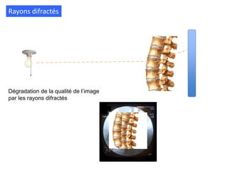 Rayons difractés
Dégradation de la qualité de l’image
par les rayons difractés
 