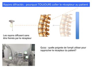 Rayons difractés : pourquoi TOUJOURS coller le récepteur au patient
Les rayons diffusent sans
être freinés par le récepteur
1
2
3
Quizz : quelle poignée de l’ampli utiliser pour
rapprocher le récepteur du patient?
 