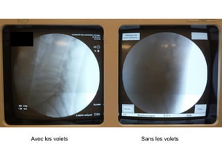 Avec les volets Sans les volets
 