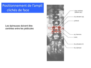 Positionnement de l’ampli
clichés de face
Les épineuses doivent être
centrées entre les pédicules
 