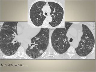 Difficultés parfois………..
 