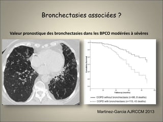 Bronchectasies associées ?
Valeur pronostique des bronchectasies dans les BPCO modérées à sévères
Martinez-Garcia AJRCCM 2013
 