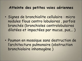 Atteinte des petites voies aériennes
• Signes de bronchiolite cellulaire : micro
nodules flous centro lobulaires , parfois
branchés (bronchioles centrolobulaires
dilatées et impactées par mucus, pus,.. )
• Poumon en mosaïque sans destruction de
l’architecture pulmonaire (obstruction
bronchiolaire inhomogène )
 