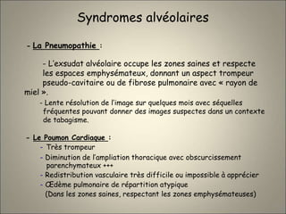 - La Pneumopathie :
- L’exsudat alvéolaire occupe les zones saines et respecte
les espaces emphysémateux, donnant un aspect trompeur
pseudo-cavitaire ou de fibrose pulmonaire avec « rayon de
miel ».
- Le Poumon Cardiaque :
- Très trompeur
- Diminution de l’ampliation thoracique avec obscurcissement
parenchymateux +++
- Redistribution vasculaire très difficile ou impossible à apprécier
- Œdème pulmonaire de répartition atypique
(Dans les zones saines, respectant les zones emphysémateuses)
- Lente résolution de l’image sur quelques mois avec séquelles
fréquentes pouvant donner des images suspectes dans un contexte
de tabagisme.
Syndromes alvéolaires
 