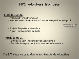 NPS volontiers trompeur
Nodule Solide:
- Prend des formes variables
- Perd ses caractères distinctifs entre bénignité et malignité
- Parfois étiquetté « séquelle »
- A part, cancérisation de bulle
Matsuoka et coll
Radiology 2005
Nodule en VD:
- Difficile à voir ( redistribution vasculaire )
- Difficle à comprendre ( infection, encombrement )
2 a 8 % chez les candidats a la chirurgie de réduction
 