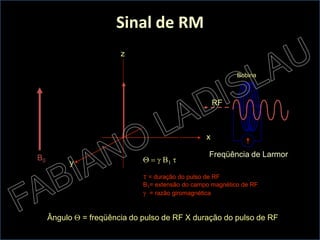 y
x
z
RF
B0
Bobina
Ângulo Q = freqüência do pulso de RF X duração do pulso de RF
Q = g B1 t
t = duração do pulso de RF
B1= extensão do campo magnético de RF
g = razão giromagnética
Freqüência de Larmor
Sinal de RM
 