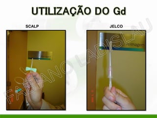 SCALP JELCO
 