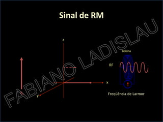 Sinal de RM

         z

                                Bobina



                           RF



                       x

B0                     Freqüência de Larmor
     y
 