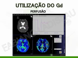 PERFUSÃO
 