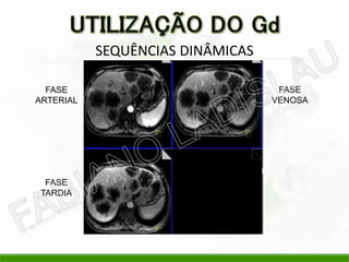 SEQUÊNCIAS DINÂMICAS

  FASE                             FASE
ARTERIAL                          VENOSA




  FASE
 TARDIA
 