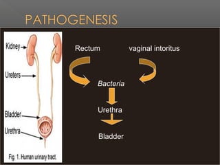 Rectum vaginal intoritus
Bacteria
Urethra
Bladder
 