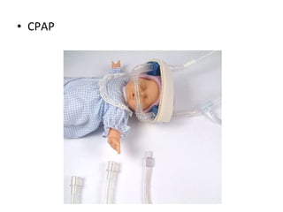 • CPAP
 