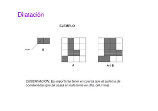 Dilatación
 