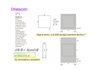 Dilatación
 