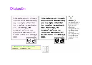 Dilatación
 