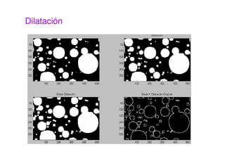 Dilatación
 