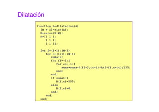 Dilatación
 