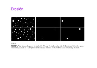 Erosión
 