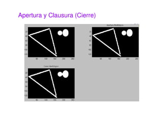 Apertura y Clausura (Cierre)
 