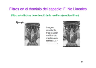 Filtros en el dominio del espacio: F. No Lineales
Filtro estadísticos de orden: F. de la mediana (median filter)
31
 