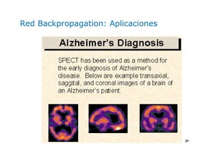 37
Red Backpropagation: Aplicaciones
 