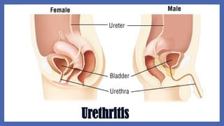 Urethritis
 