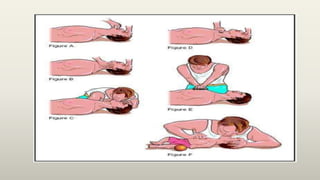 Cardio Pulmonary Resuscitation | PPTX