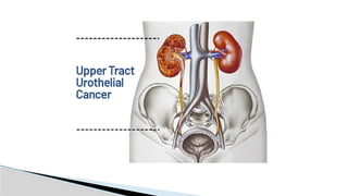 Utuc Presentation UTUC & MUSCLE INVASIVE BLADDER CA POWERPOINT PRESENTATION | PPTX