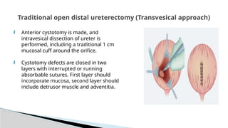Utuc Presentation UTUC & MUSCLE INVASIVE BLADDER CA POWERPOINT PRESENTATION | PPTX