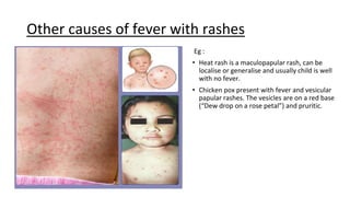 Diffuse Dew Drop Rash ATUCU-5.pptx