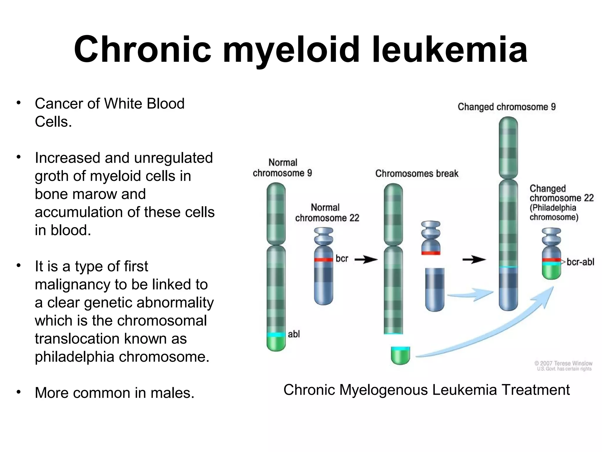 Chronic myeloid leukemia
• Cancer of White Blood 
Cells.
• Increased and unregulated 
groth of myeloid cells in 
bone marow and 
accumulation of these cells 
in blood.
• It is a type of first 
malignancy to be linked to 
a clear genetic abnormality 
which is the chromosomal 
translocation known as 
philadelphia chromosome.
• More common in males. Chronic Myelogenous Leukemia Treatment
 
