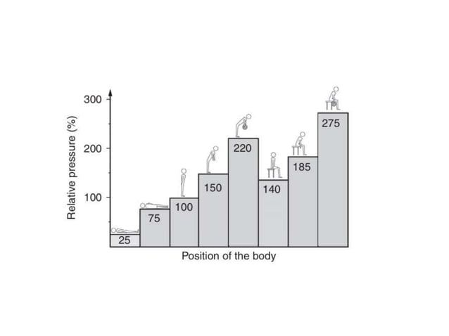 Lumbar intervertebral disc anatomy, biomechanics and pathogenesis of ...